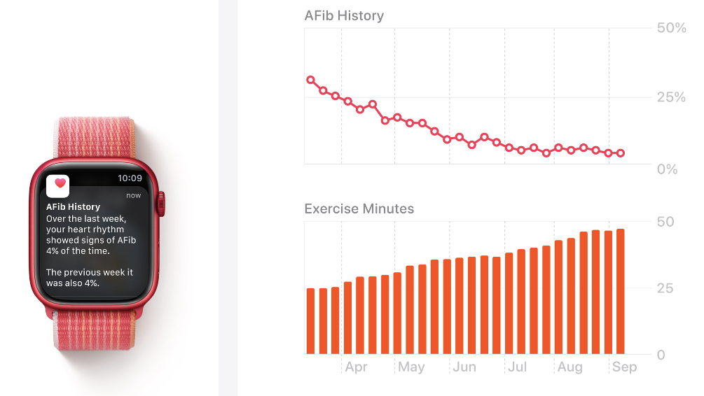 AFib History